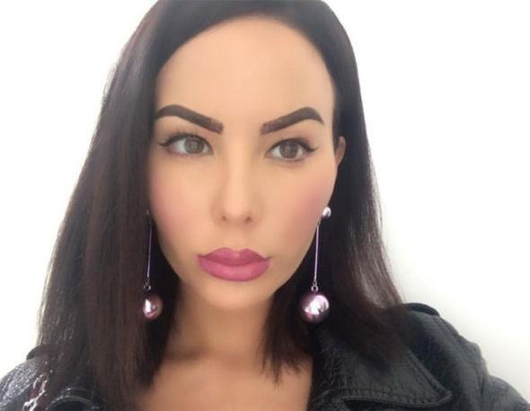 Anasına bənzəməmək üçün 200 əməliyyat keçirdi -  FOTOLAR